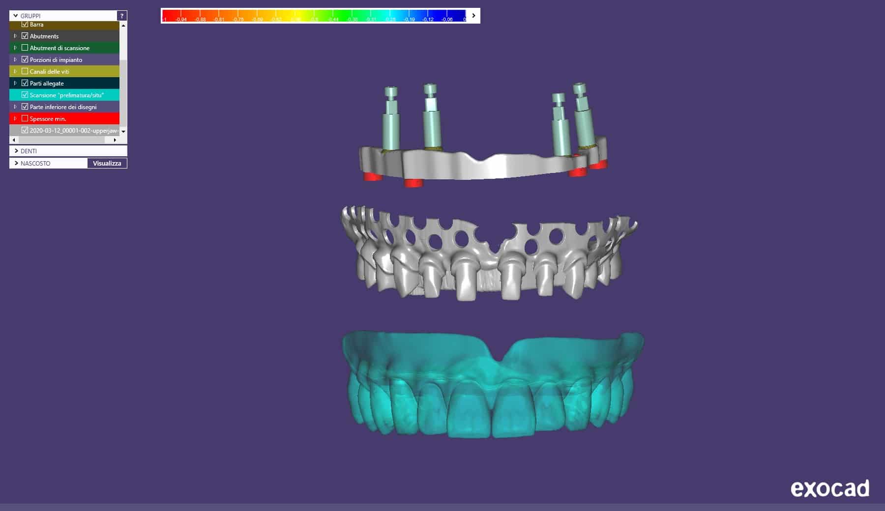 Figura 1: progettazione virtuale.