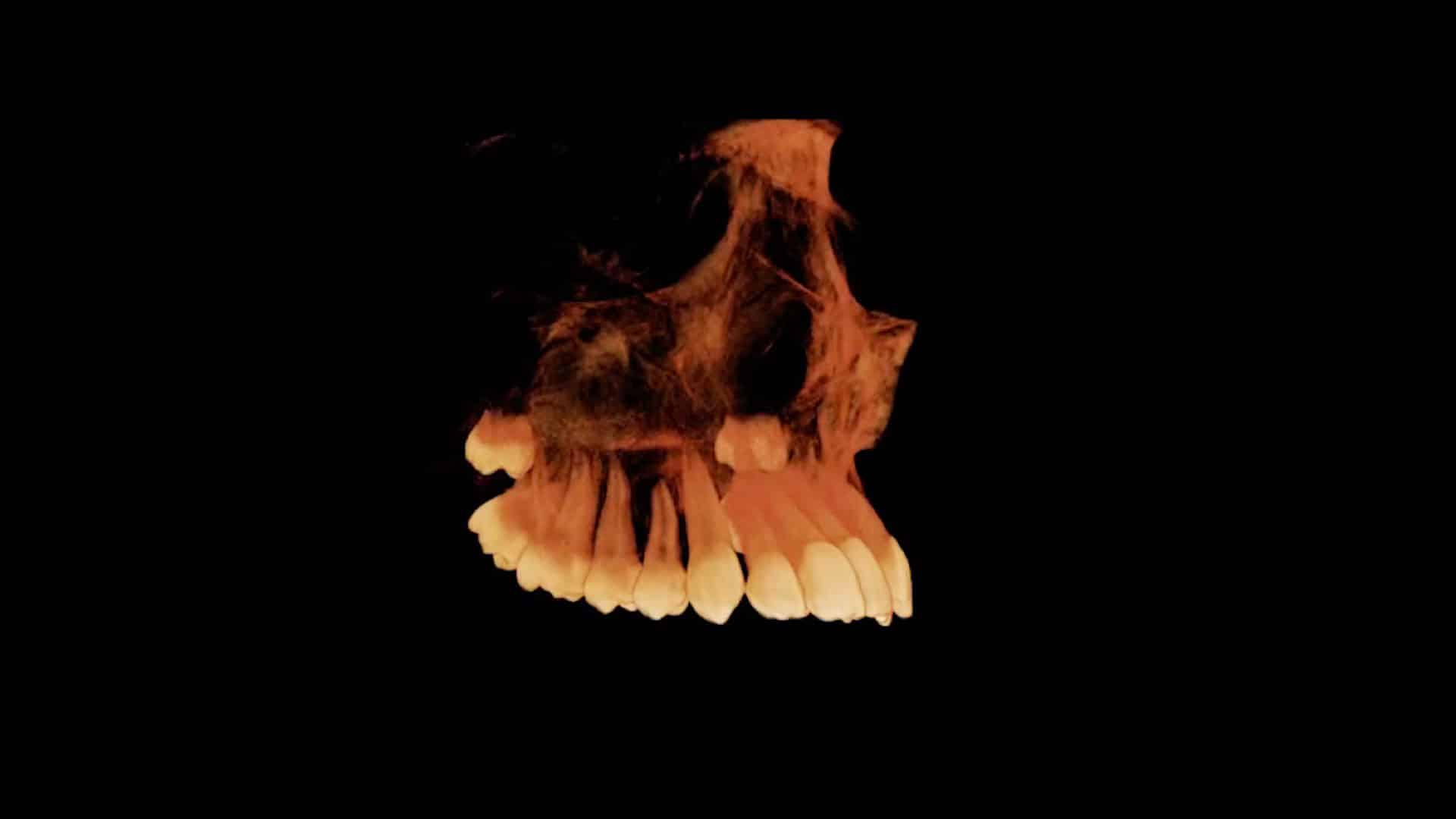 Fig 1a