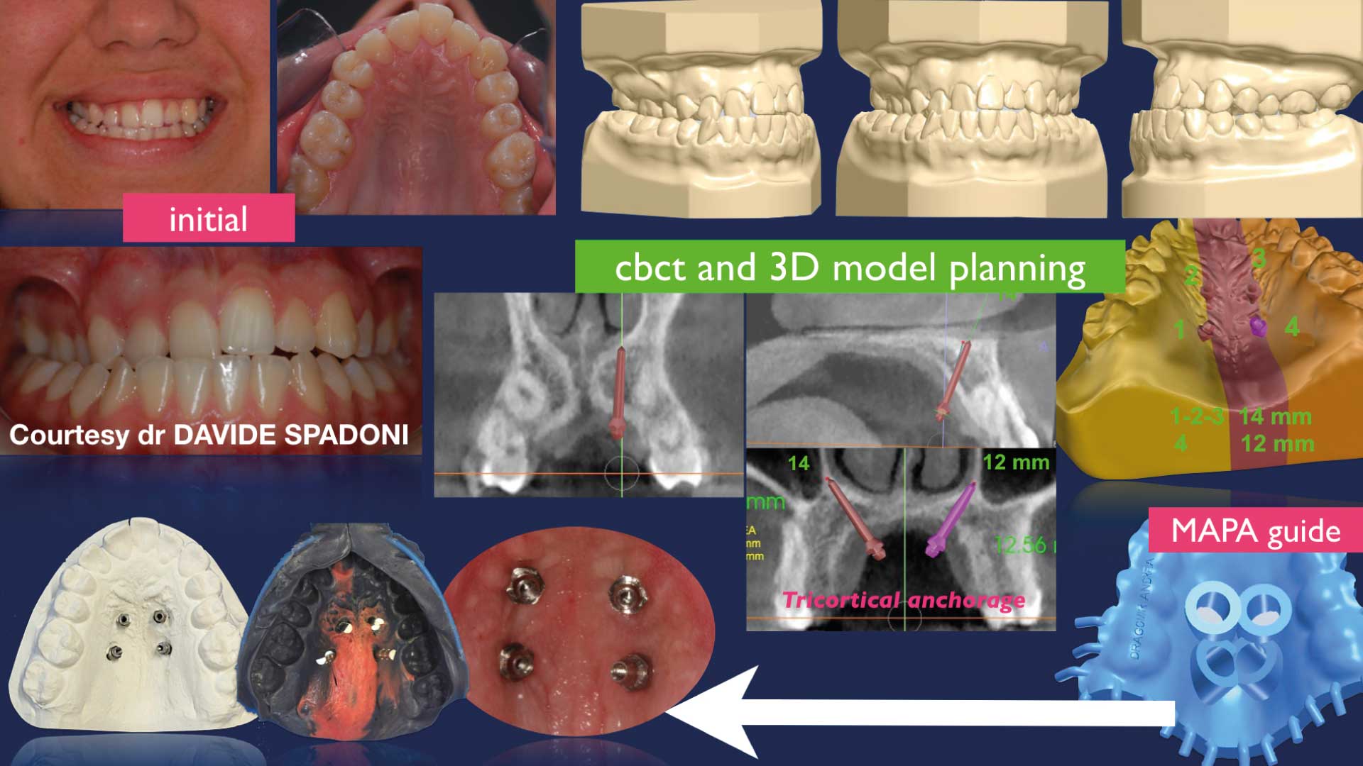 Fig 13