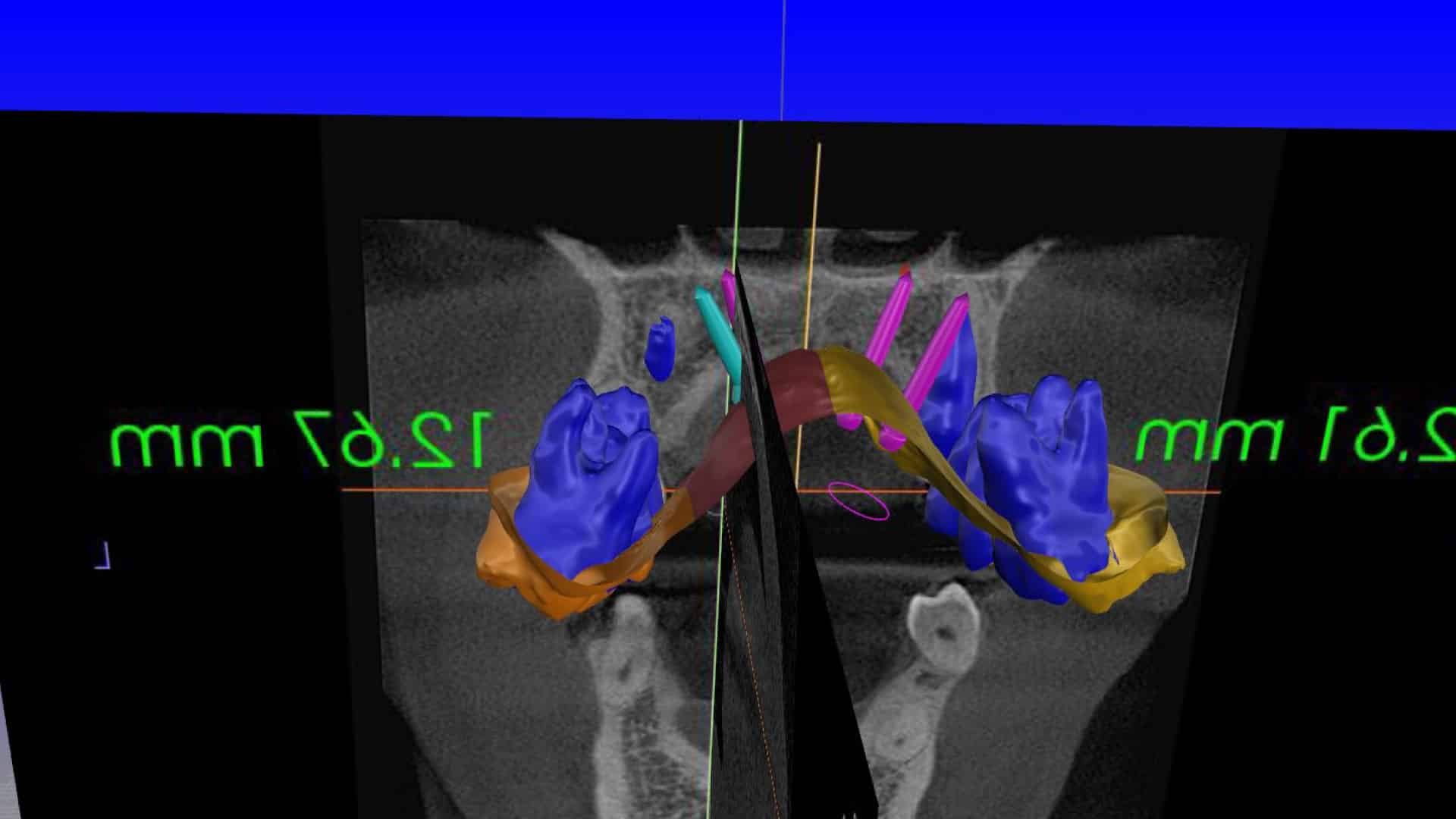 Fig 3