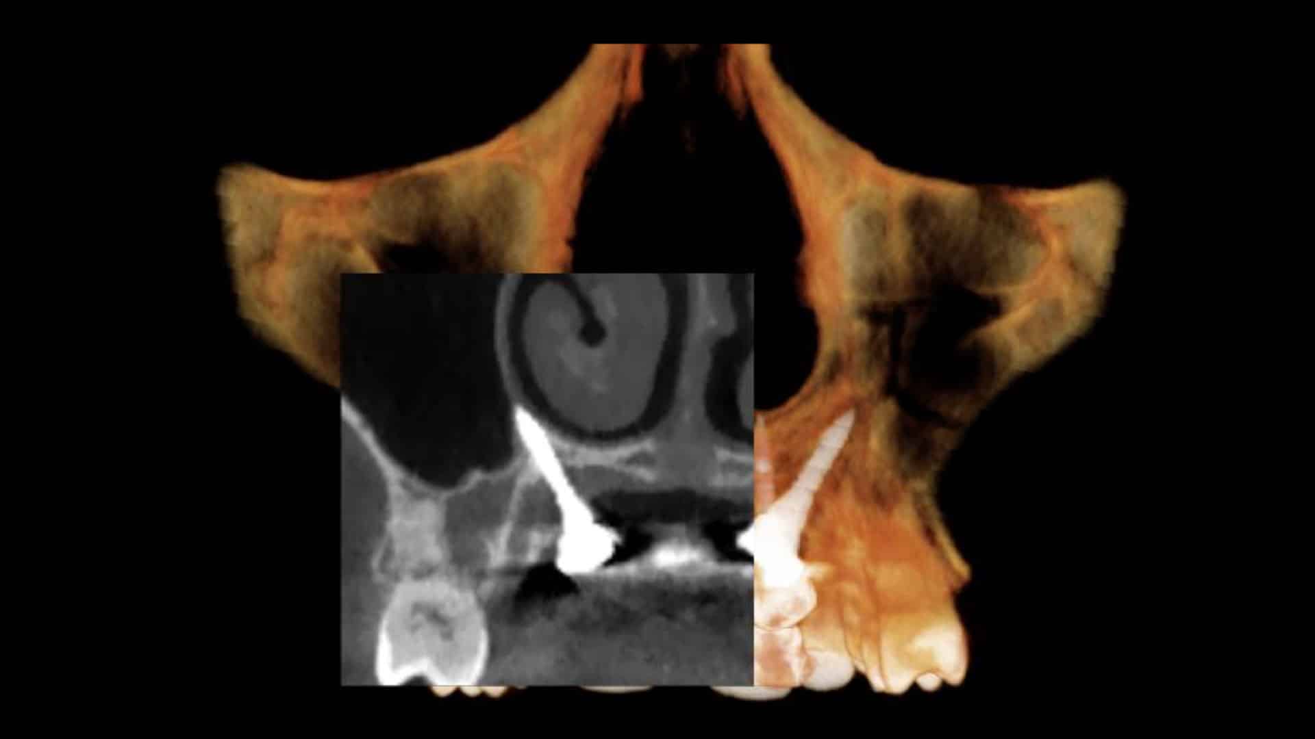 Fig 5
