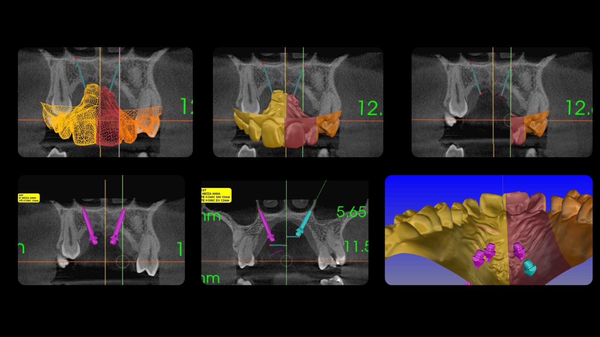 Fig 6
